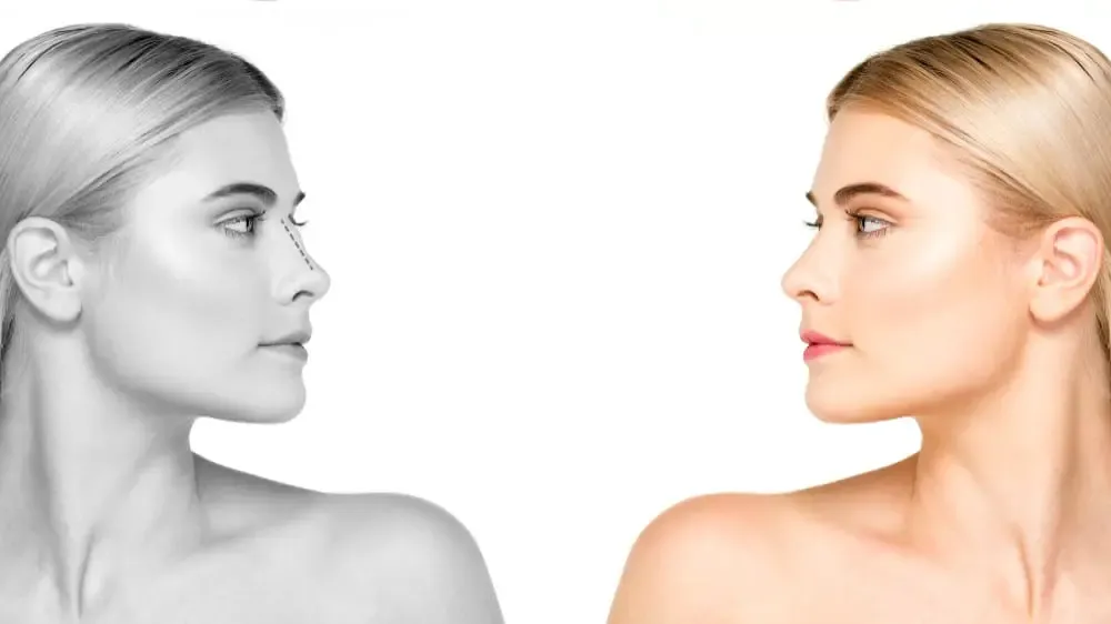 Cosmetic and plastic surgery: discover their differences