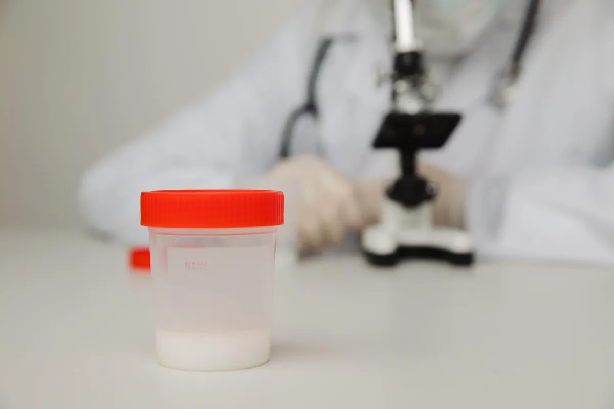 Frasco de muestra para espermograma en un laboratorio de análisis de fertilidad masculina