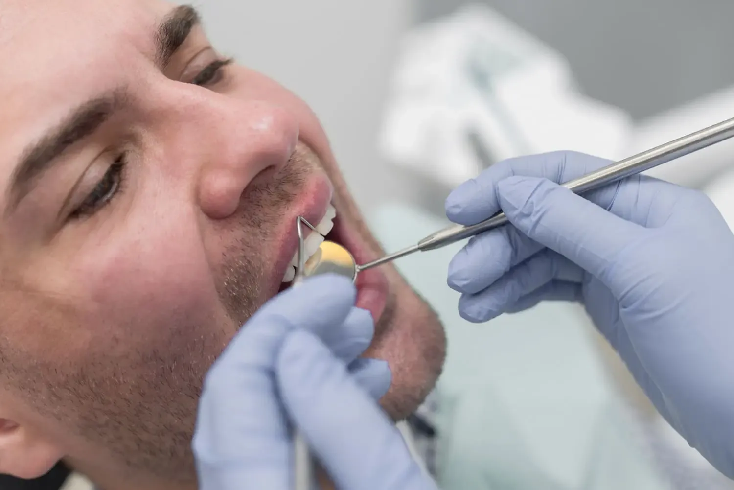 Wisdom tooth extraction: complete guide and quick recovery